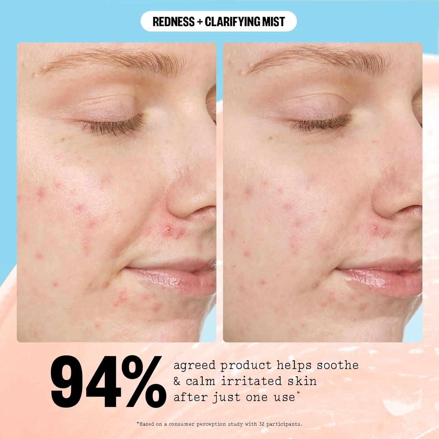 PEACE OUT Redness + Clarifying Mist, Hypochlorous Acid Facial Spray for Acne-Prone Skin, Helps Calm Redness, Control Excess Oil, and Refresh Skin Over and Under Makeup, 3.3 fl oz - Image 3