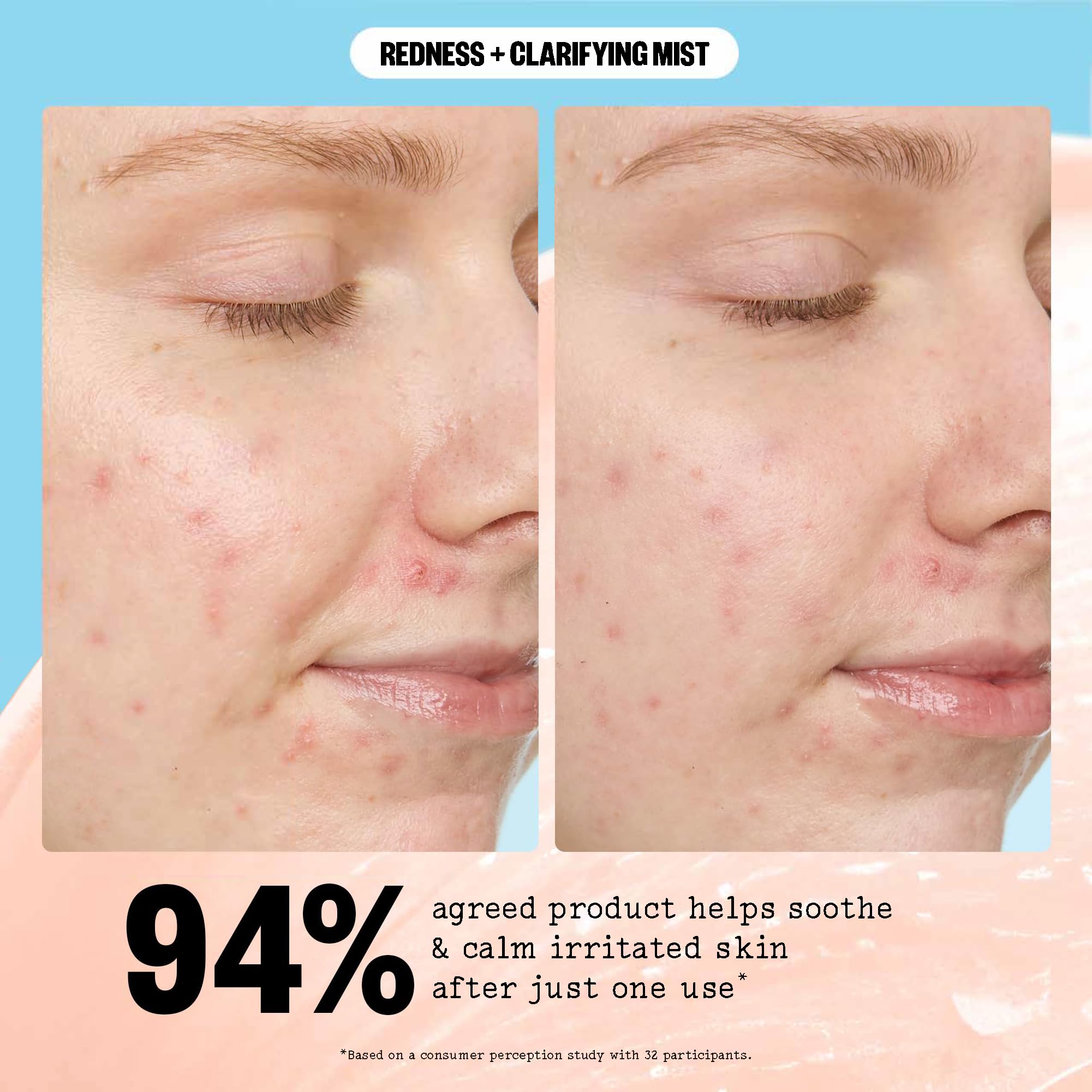 PEACE OUT Redness + Clarifying Mist, Hypochlorous Acid Facial Spray for Acne-Prone Skin, Helps Calm Redness, Control Excess Oil, and Refresh Skin Over and Under Makeup, 3.3 fl oz