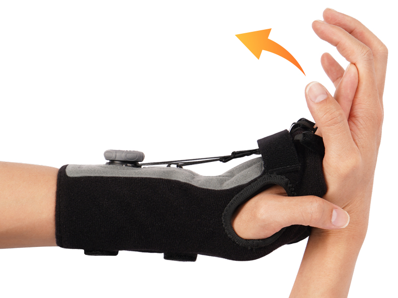 Amazon.com: Feamero Radial Nerve Palsy Splint with Knob