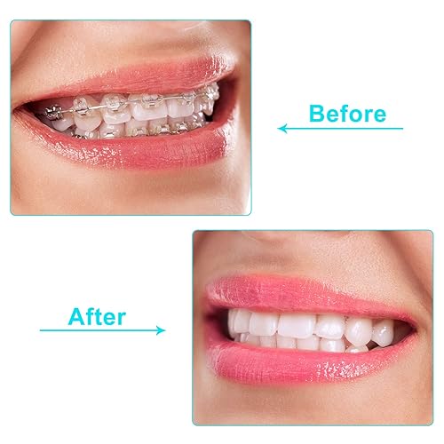 Miniatura 6 de Boao 20 bandejas de alineación masticables para bandejas de alineador, bandejas de alineación (rosa, naranja, verde, morado, blanco)