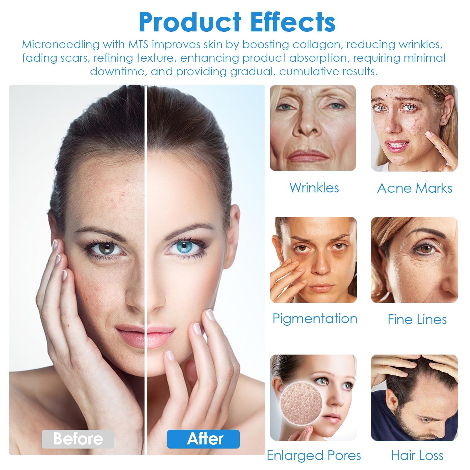 Dr.pen Ultima A7, Microneedle Eléctrico Auto Stamp, Máquina de Microagujas Ajustablede con 22 Cartuchos para Acne Perdida Cabello Arrugas Estrías Cicatriz, Derma Pen 0-2.5mm para Facial y Cuerpo