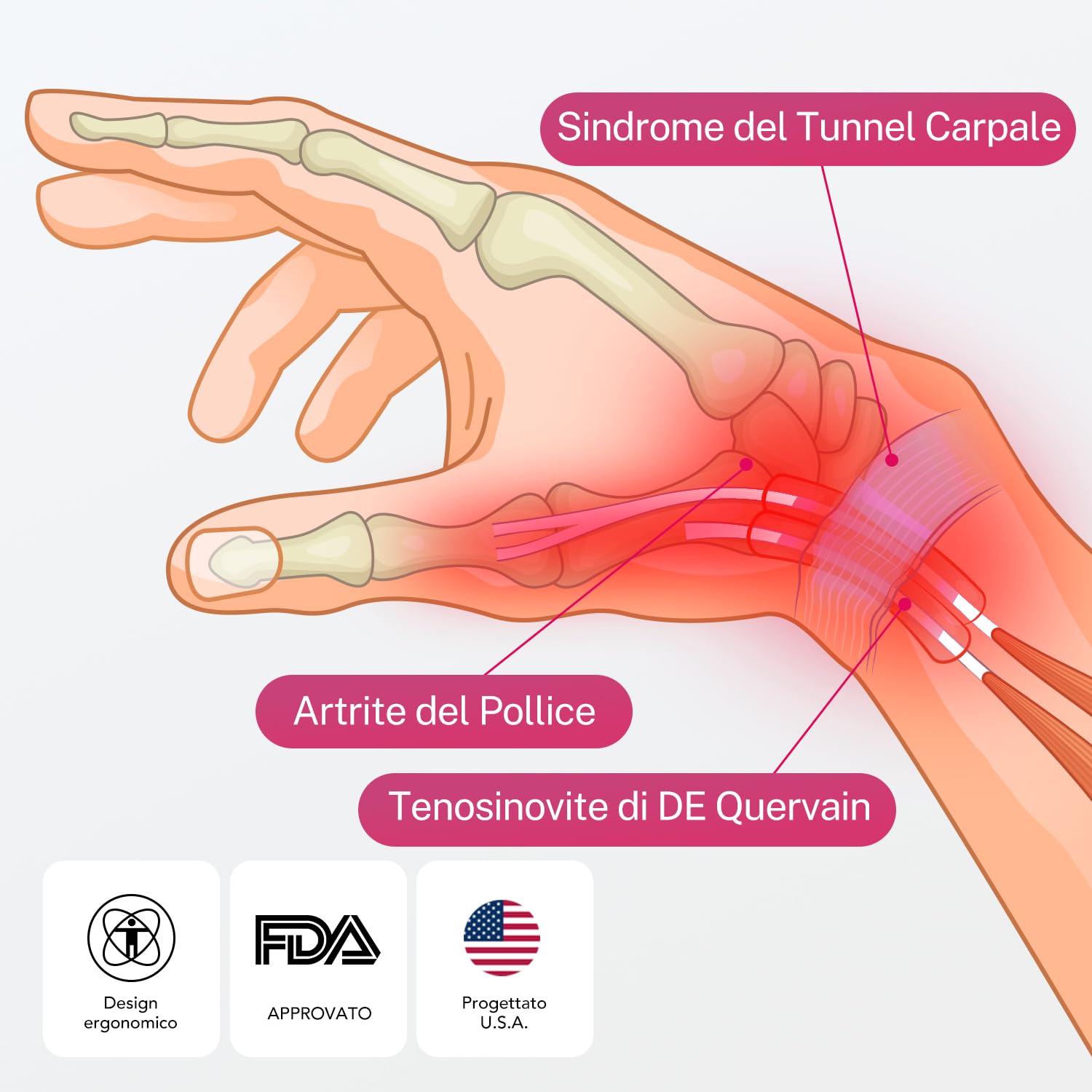Fitomo Tutore Pollice, Tutore Tunnel Carpale 2 in 1 per Tenosinovite di De Quervains, Artrite, dito a Scatto, Tendinite, Sollievo dal Dolore del Tunnel Carpale e Distorsione del Pollice