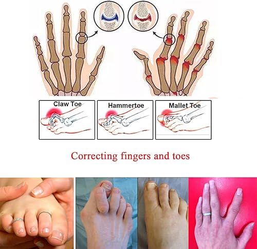 Miniatura 3 de 20 envolturas para dedos rotos, vendajes acolchados, férulas separadoras de dedos en martillo, puntera recta, envoltura para dedos de martillo,