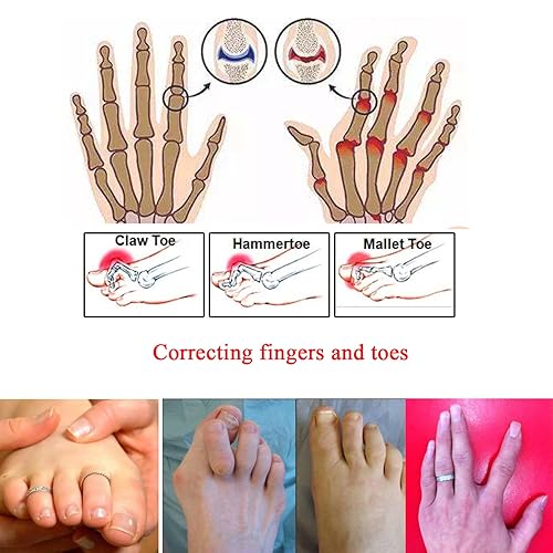 Miniatura 3 de 20 envolturas para dedos rotos, vendajes acolchados, férulas separadoras de dedos en martillo, puntera recta, envoltura para dedos de martillo,