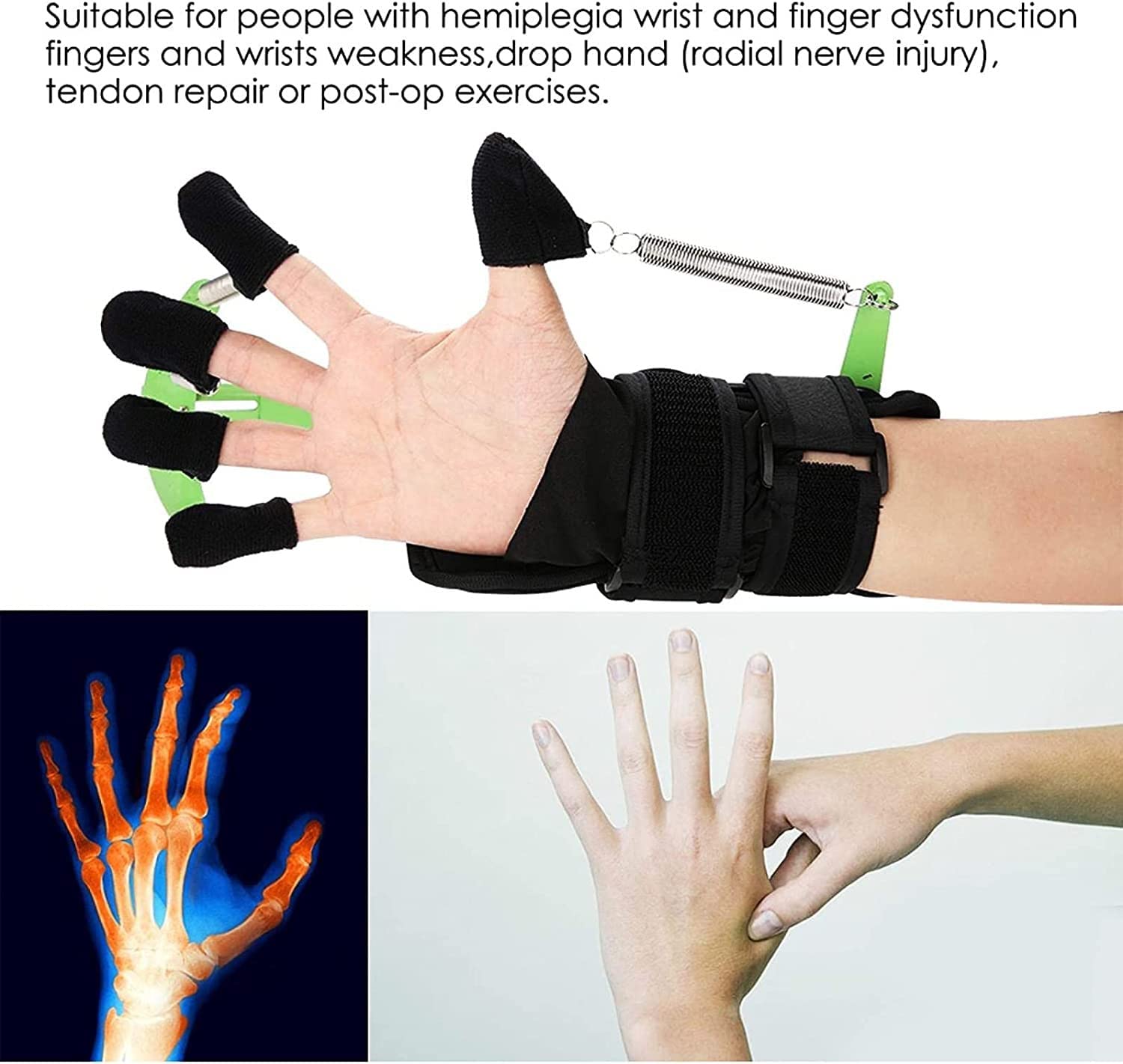 Ortesis Protectora de Férula para Dedos, Rehabilitación de Manos Ortesis de Dedo, para Accidentes Cerebrovasculares Pacientes con Hemiplejia