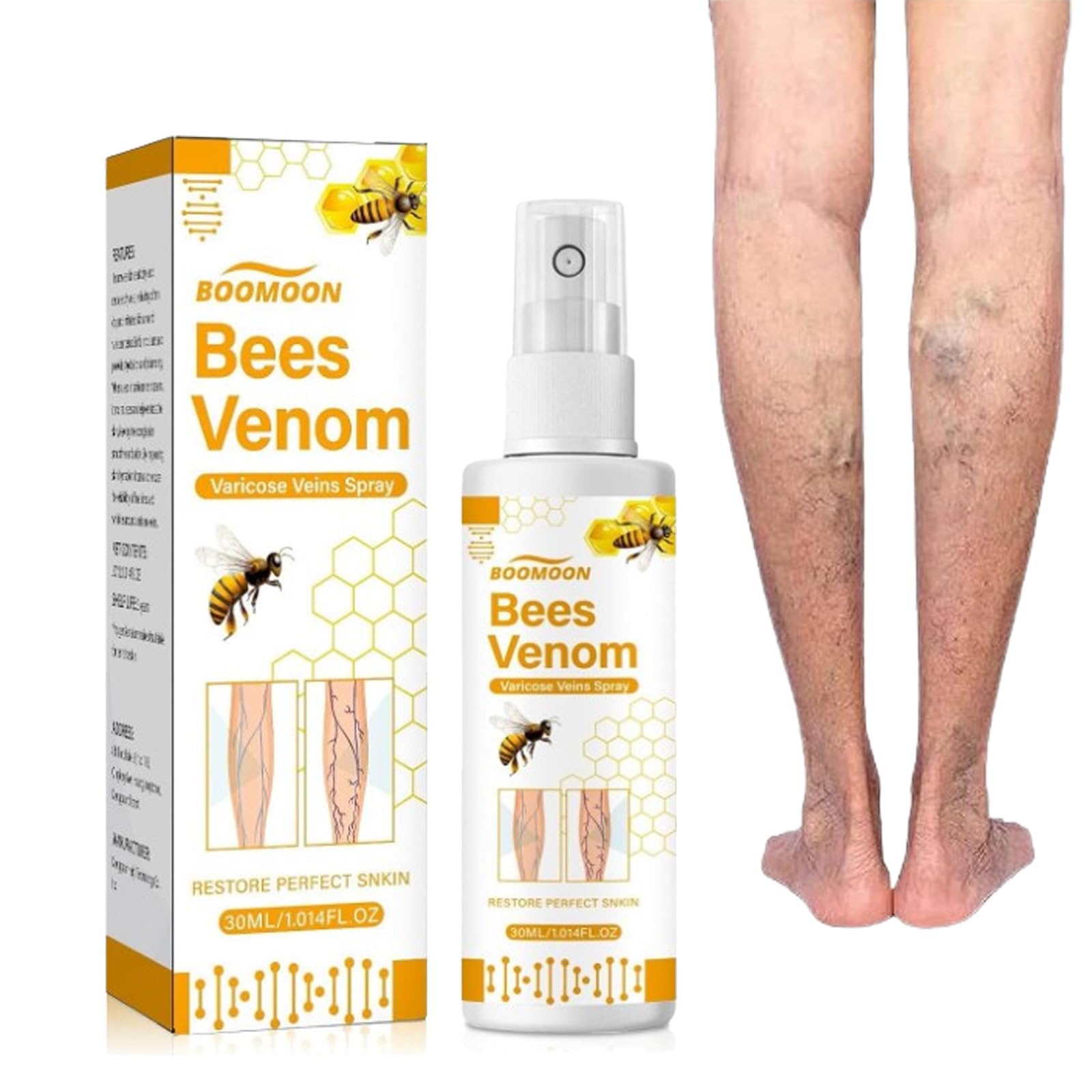 Bee Venom Varicose Veins Treatment Spray, Bee Venom Varicose Relief Veins Cream, Spider Veins Treatment Spray, Relief Spider Varicose Vein (1pcs)
