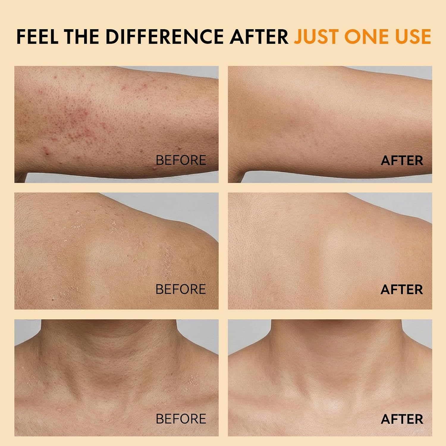 Keratin Care Kojic Acid Turmeric Exfoliating Body Spray with Soft Sponge — Brightening & Smoothing Peeling Solution for Rough, Dull Skin, All Skin Types, 100ml - Image 4