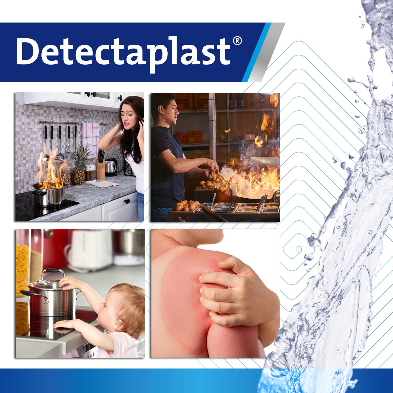 Detectaplast Kit de quemaduras con compresas para quemaduras, gel para heridas, vendajes, guantes, compresas estériles de hidrogel y ungüento para quemaduras – Set de quemaduras