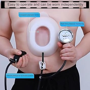 Vacuum Bell therapy- Physical Correction of Pectus Excavatum(L-L)
