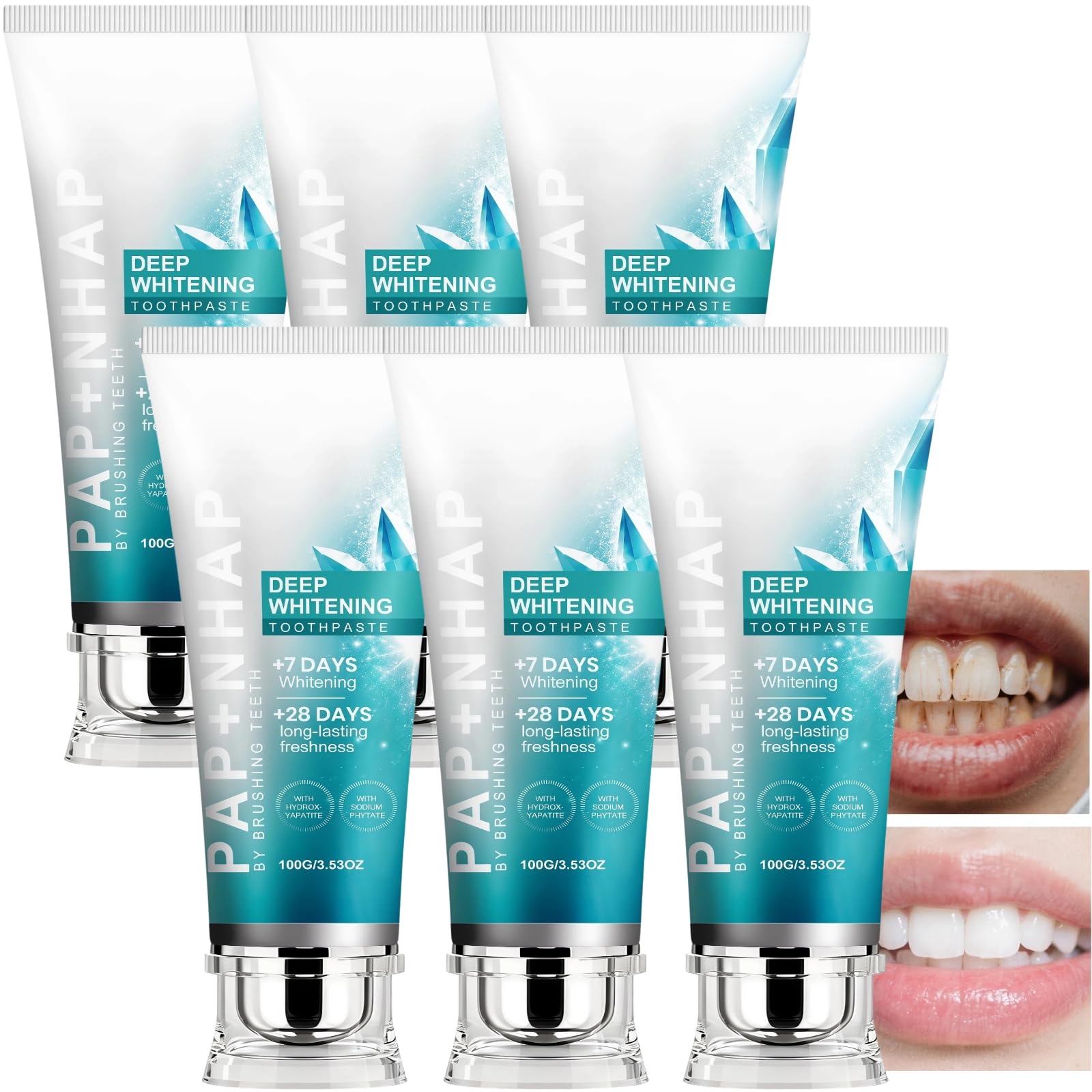 Dentifrice à l'hydroxyapatite sans fluor, dentifrice blanchissant pour dents sensibles, renforce l'émail et protège les gencives, formule douce pour un blanchiment quotidien et une haleine (6pcs)