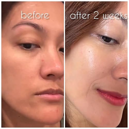 Miniatura 8 de All Time One Cream All in One Cream 3.4 fl oz / 3.38 FL. oz Crema hidratante de hidrógeno para el cuidado de los poros