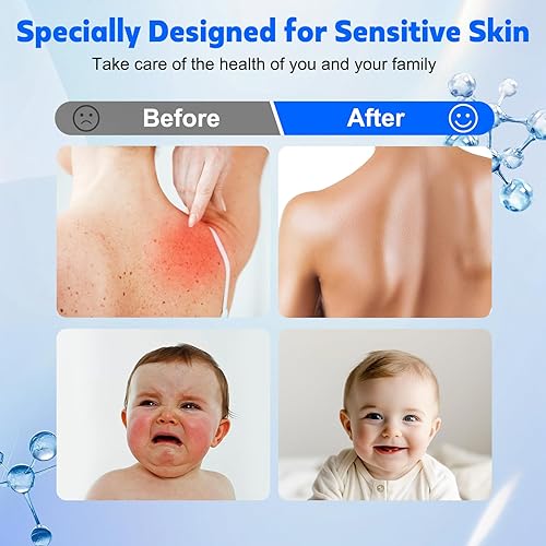 Miniatura 3 de Yvelines - Filtro de agua de baño de 15 etapas para grifo de bañera, 7500 galones, suaviza el agua dura y elimina el cloro para una piel y cabello