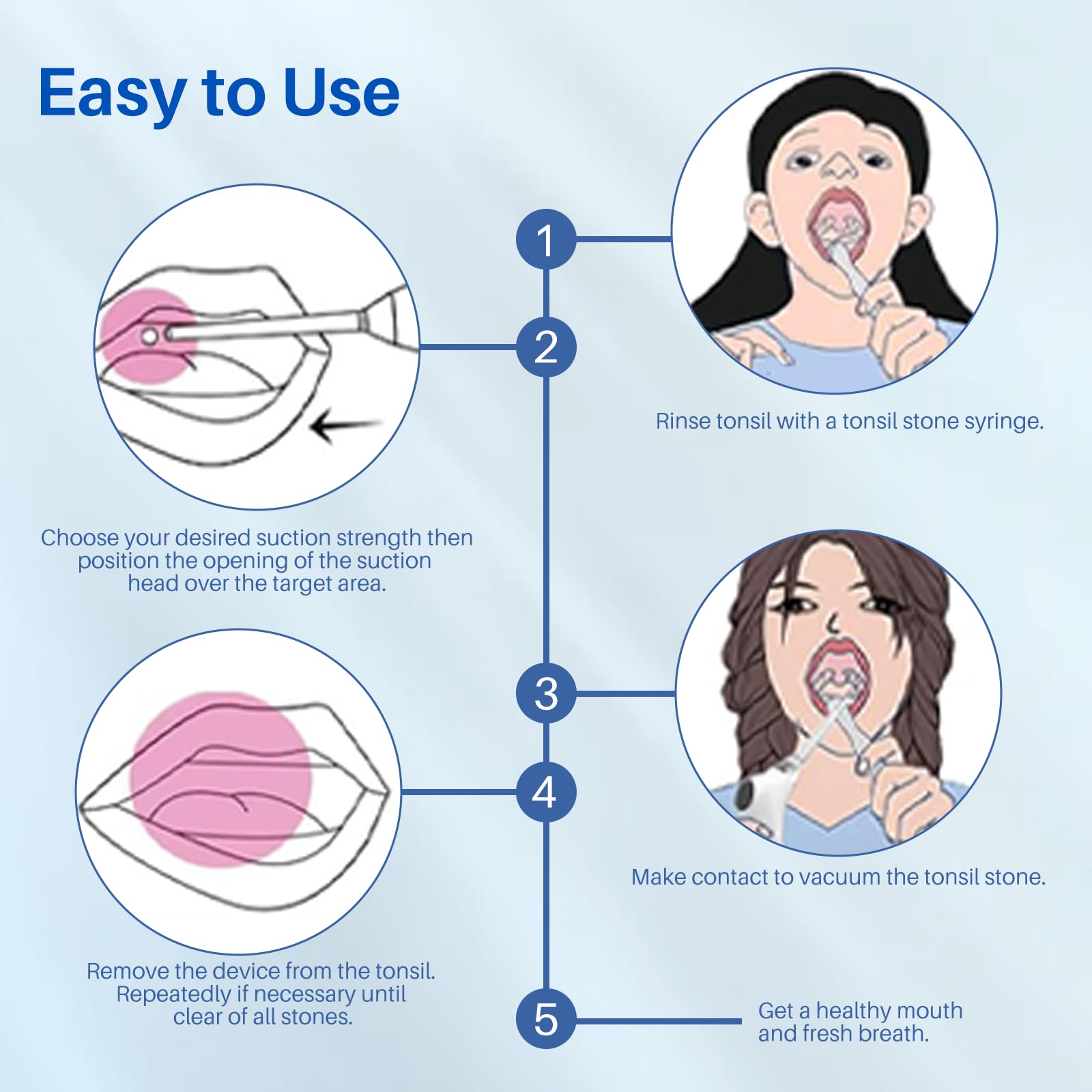 Vhipu Kit elettrico per la rimozione dei calcoli tonsillari, Rimuove rapidamente i calcoli tonsillari, alito fresco,Batteria 800mAh per lunga durata, Conveniente e adatto per viaggi e uso domestico.