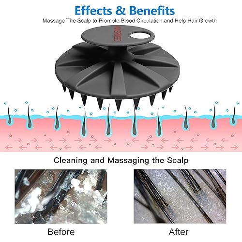 Miniatura 5 de INNERNEED Cepillo de champú masajeador para cuero cabelludo, cuidado manual del cuero cabelludo húmedo y seco, lavado de cabeza, cerdas de silicona