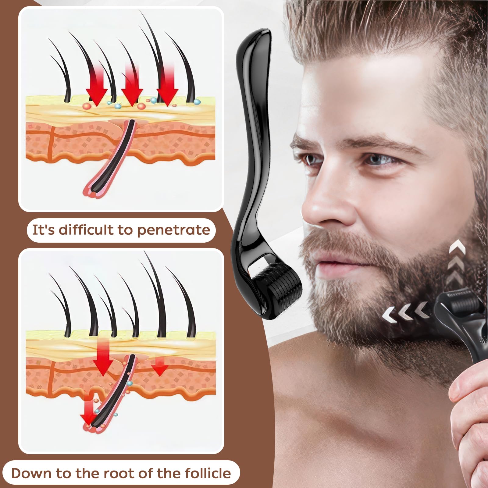 Dermaroller Capelli, Microneedling Derma Roller,Micro-Ago Roller 540-Aghi Rullo Derma per Crescita Dei Capelli,Trattamento di Perdita Capelli,Cicatrici da Acne e Smagliature,Delle Rughe(0,5 mm Nero)