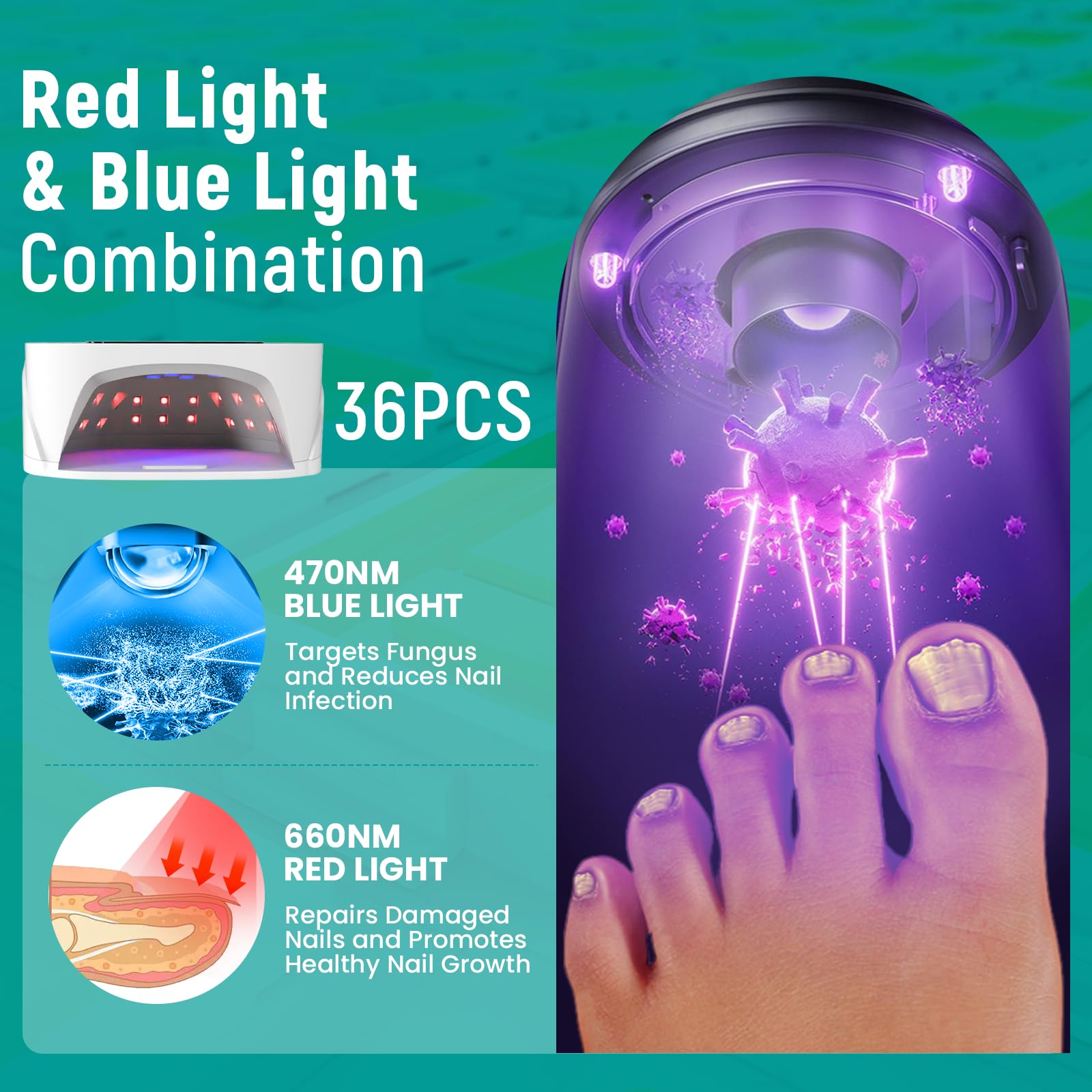 iKeener Mycose Ongles des Pieds Laser Appareil, Sans fil Lumière Bleue et Rouge Appareil Anti Mycose Ongle Pied avec 36pcs de Lampe, pour Plusieurs Ongles des Pieds et des Mains