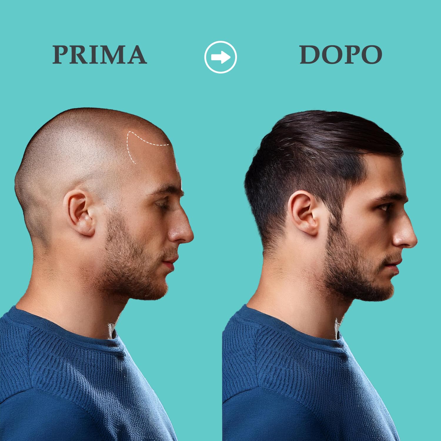 YPHARMA Integratore Tricostamyl Capelli e Unghie 90 Capsule per la Salute di Pelle, Capelli e Unghie con Biotina, Zinco, Estratto di Miglio e Estratto di Equiseto