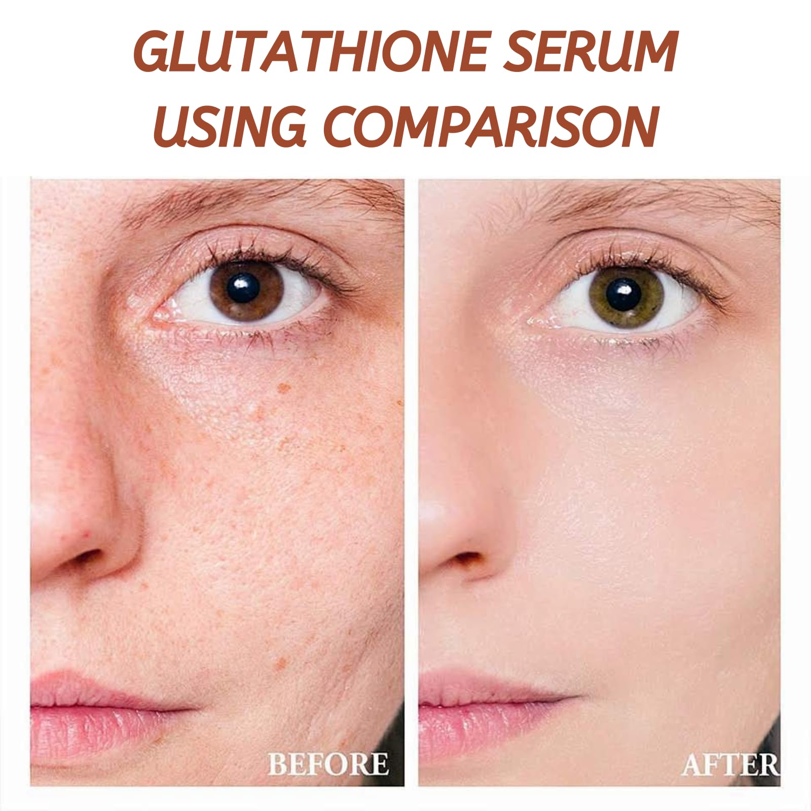 glutathione for hyperpigmentation reddit TOSOWOONG Arbutin 7% + Tranexamic Acid 4% Cream, 70,000ppm Arbutin, 40,000ppm TXA, Niacinamide, Glutathione, Dark Spots, Freckle, Blemishes, Pigmentation, Korean Skin Care, 50ml, 1.69 fl.oz. : Beauty & Personal Care Could really use advice for