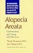 Alopecia Areata: Understanding and Coping with Hair Loss