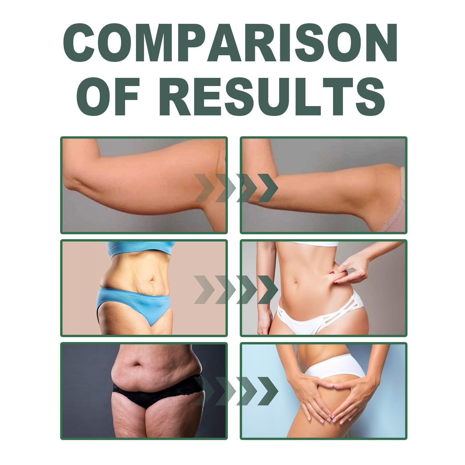 Collagen Lifting Body Oil with Vitamin E & Rosemary - Firming & Tightening Oil for Neck, Chest, Arms, Thighs - Hydrating Formula for Silky, Fresh, Luminous, and Supple Skin - 100ml (1PC) - 5