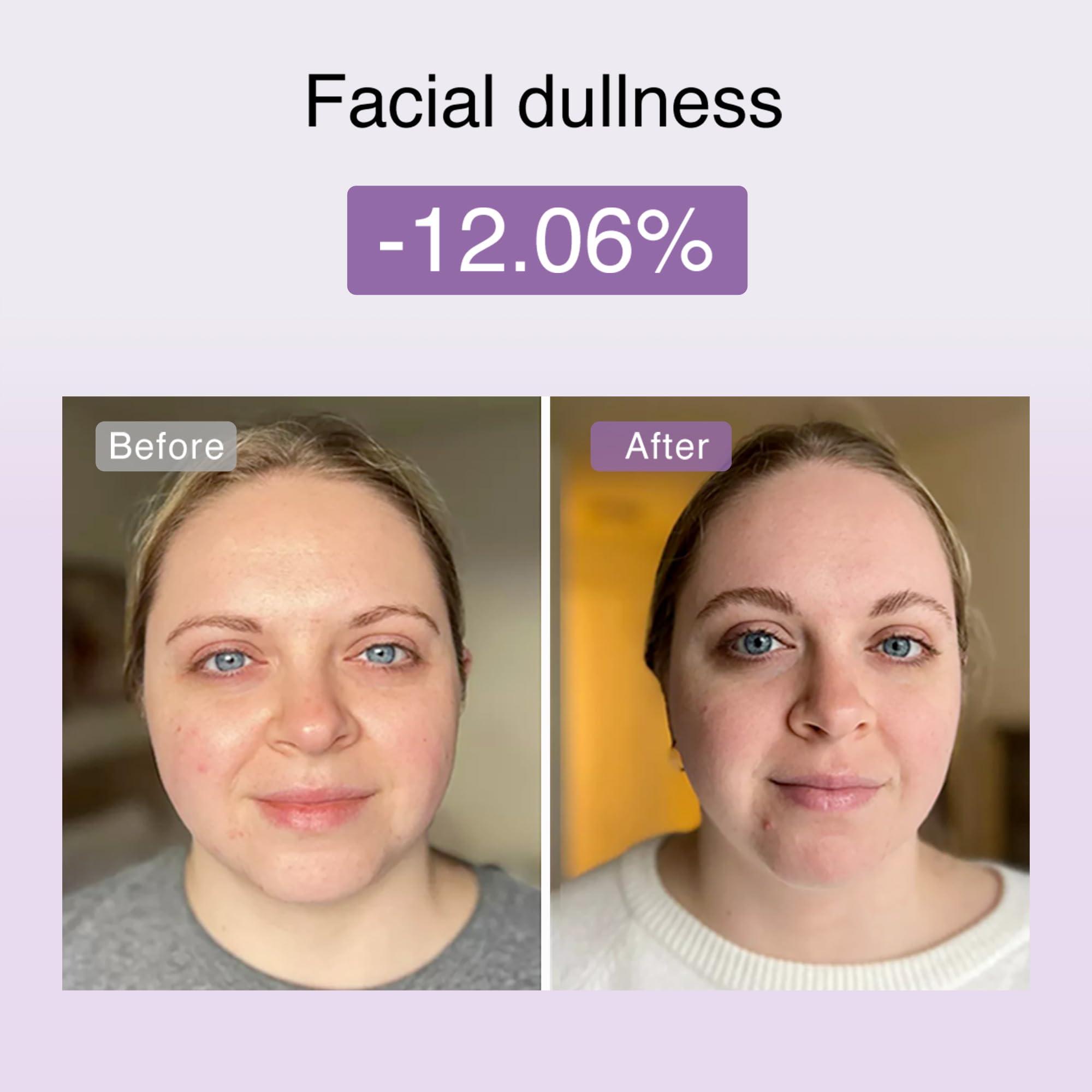 DermRays Neue Kosmetik M1,4 Limo Little Face, Leds Red Light, Leds Geräte, Die für Anti-aging Sorgen, Gesicht Strafft, Falten, Brust Und Ausstrahlung
