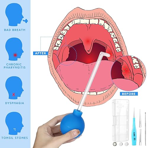 Miniatura 3 de Kit de eliminación de piedras amígdalas de 7 piezas, herramienta de eliminación de piedra de amígdala, limpiador de estilo manual, limpiador bucal,