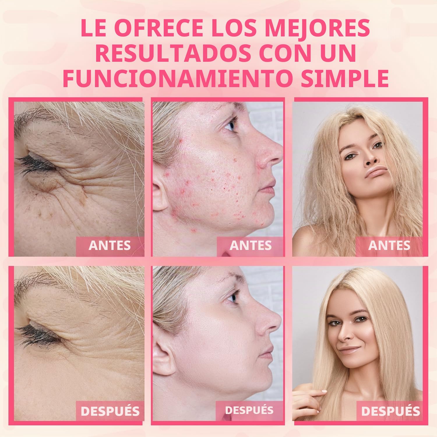TUMAKOU Máquina Alta frecuencia Estetica Facial - Dispositivo Portátil de Alta Frecuencia - con 4 varitas
