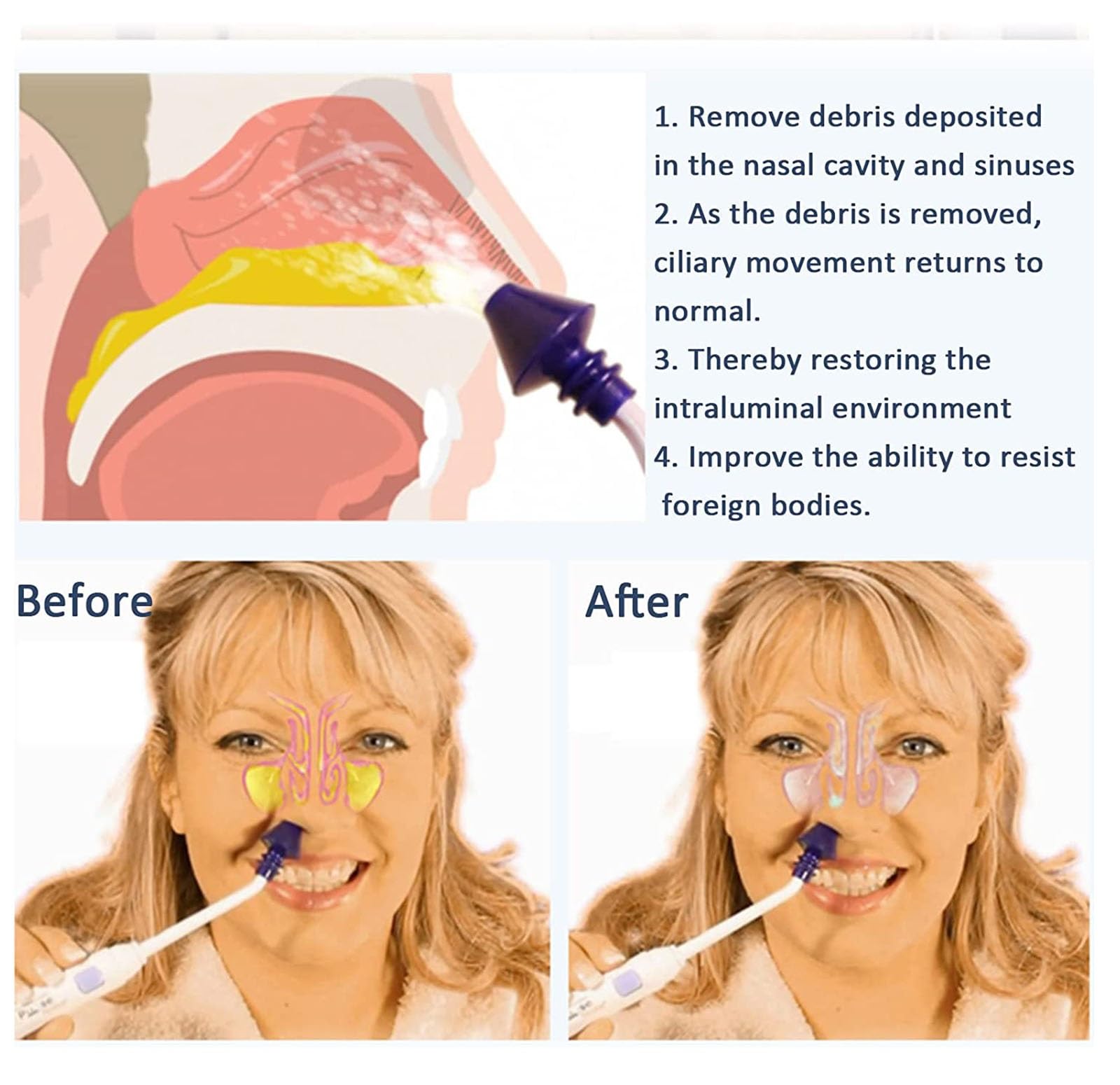 CEEBUS Neti Pot eléctrico portátil, 7 Modos de Limpieza de la Nariz, fitug pulsante Nasal Wash Sistema de Irrigación, Sinus Rinse Kit para Adultos Niño