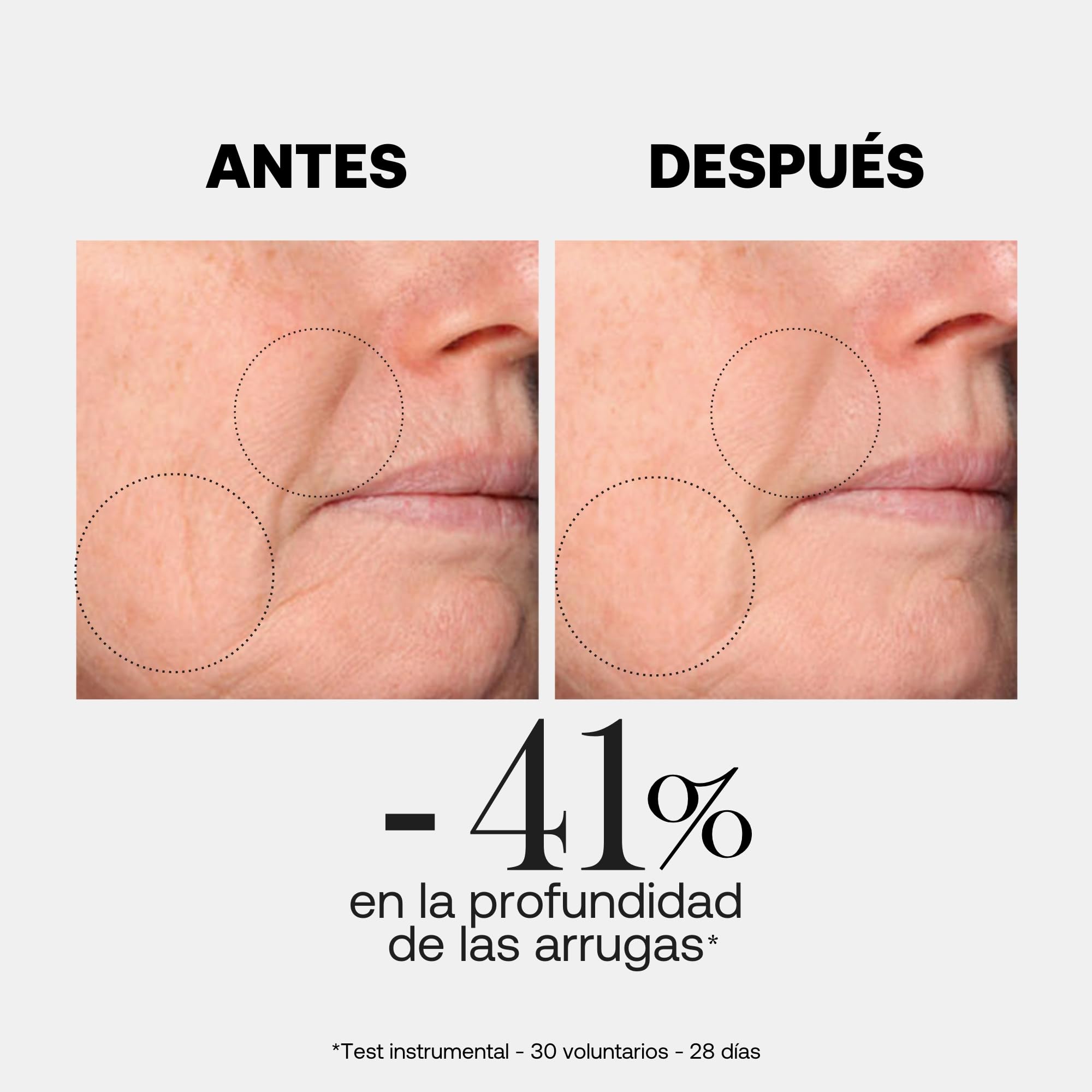 Rexaline LINE KILLER Crema Antiarrugas Reafirmante – Ácido Hialurónico RX2 y Lipopeptidos DWK – Alisa, Rellena y Reafirma – Pieles Maduras – 50 ml