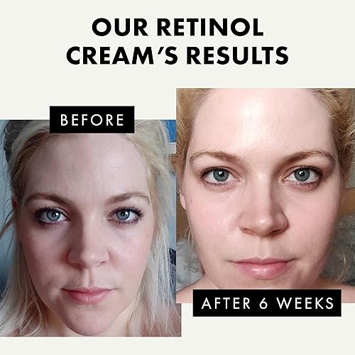 Miniatura 3 de Plump & Smooth - Hidratante facial con vitamina C + crema hidratante facial con retinol - 100% vegano y desarrollado por dermatólogos