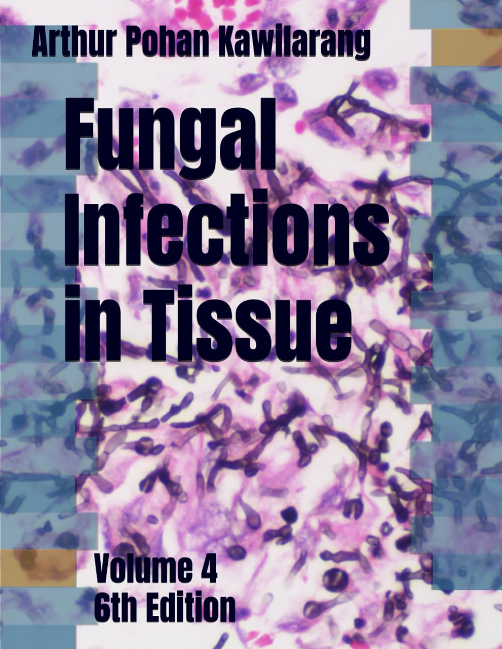 Fungal Infections in Tissue: Volume 4