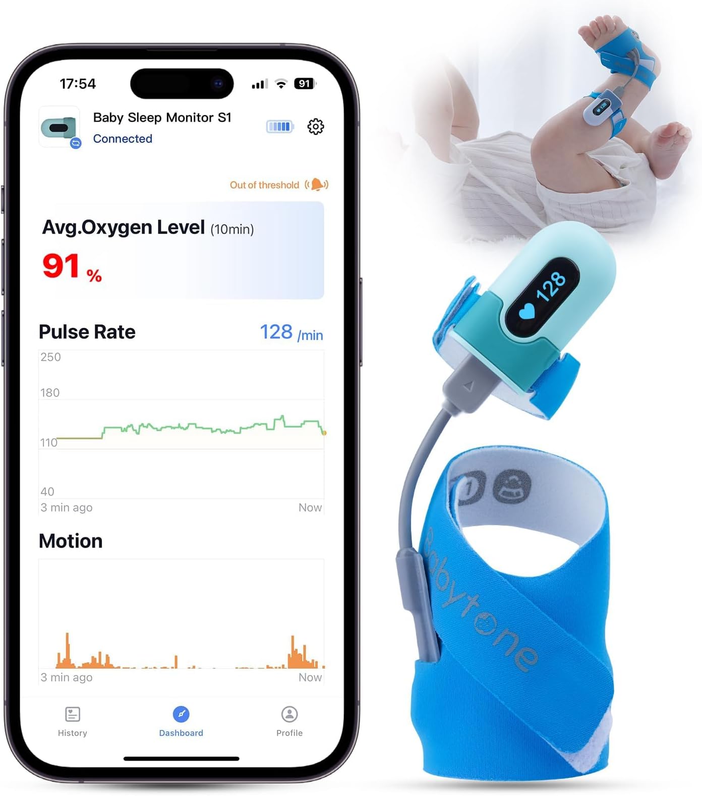 Babytone Baby Oxygen Monitor, Baby Sleep Monitor, Tracking Avg O2, Pulse Rate and