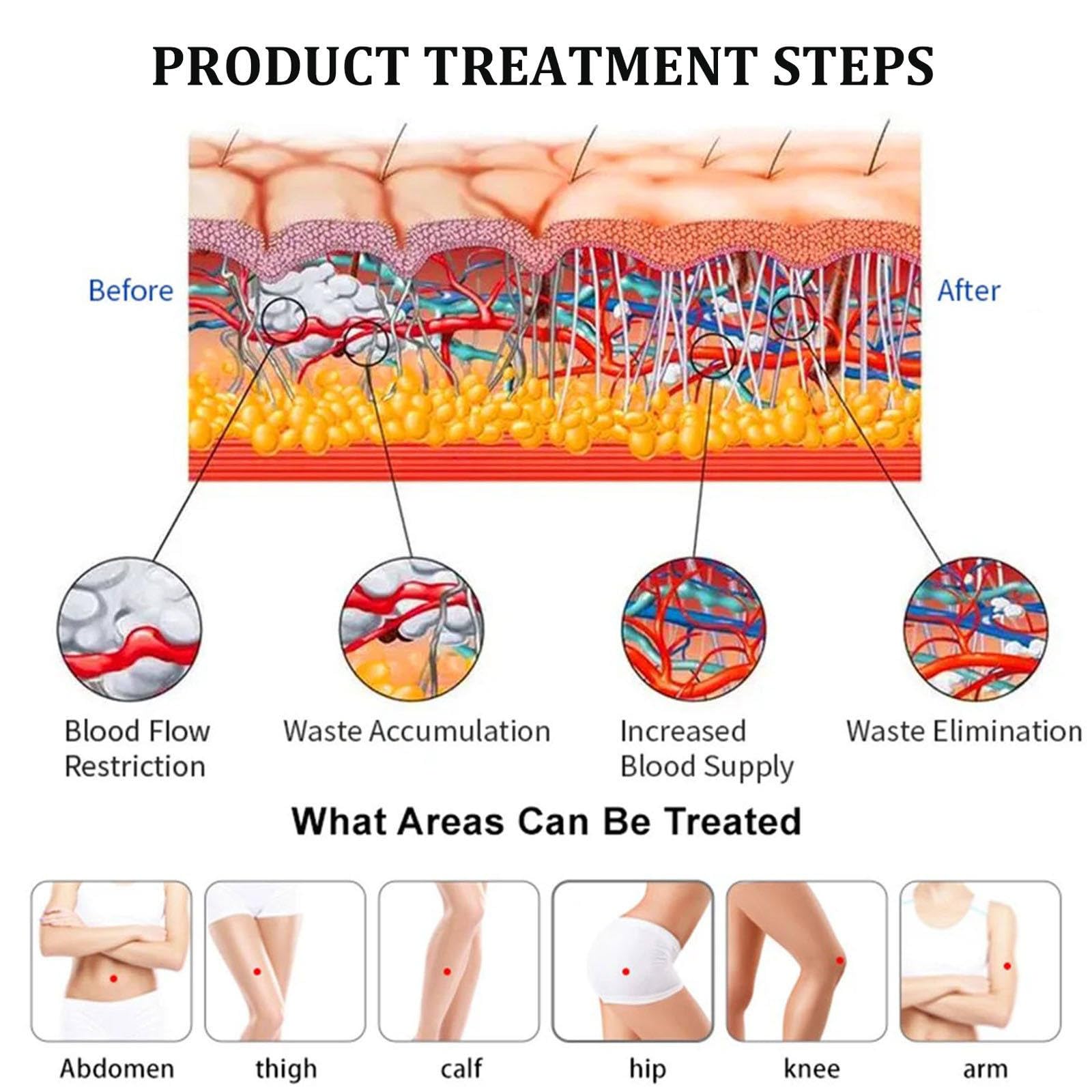Apparecchio per terapia extracorporea a onde d'urto, apparecchiatura per fisioterapia della disfunzione erettile, massaggiatore per tutto il corpo per rilassamento muscolare, sollievo dal dolore,