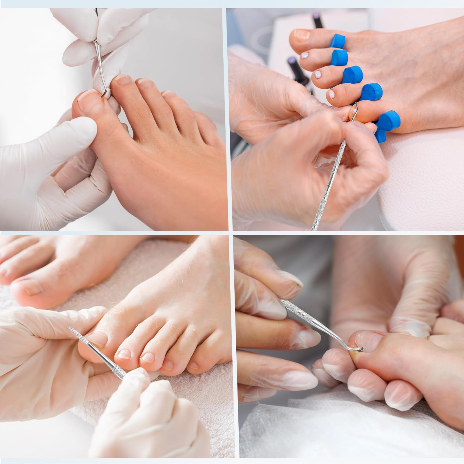 6 limas y levantadores de uñas encarnadas, herramienta profesional de acero inoxidable quirúrgico para uñas encarnadas, tratamiento seguro de limpieza de uñas, kit de herramientas de pedicura 3