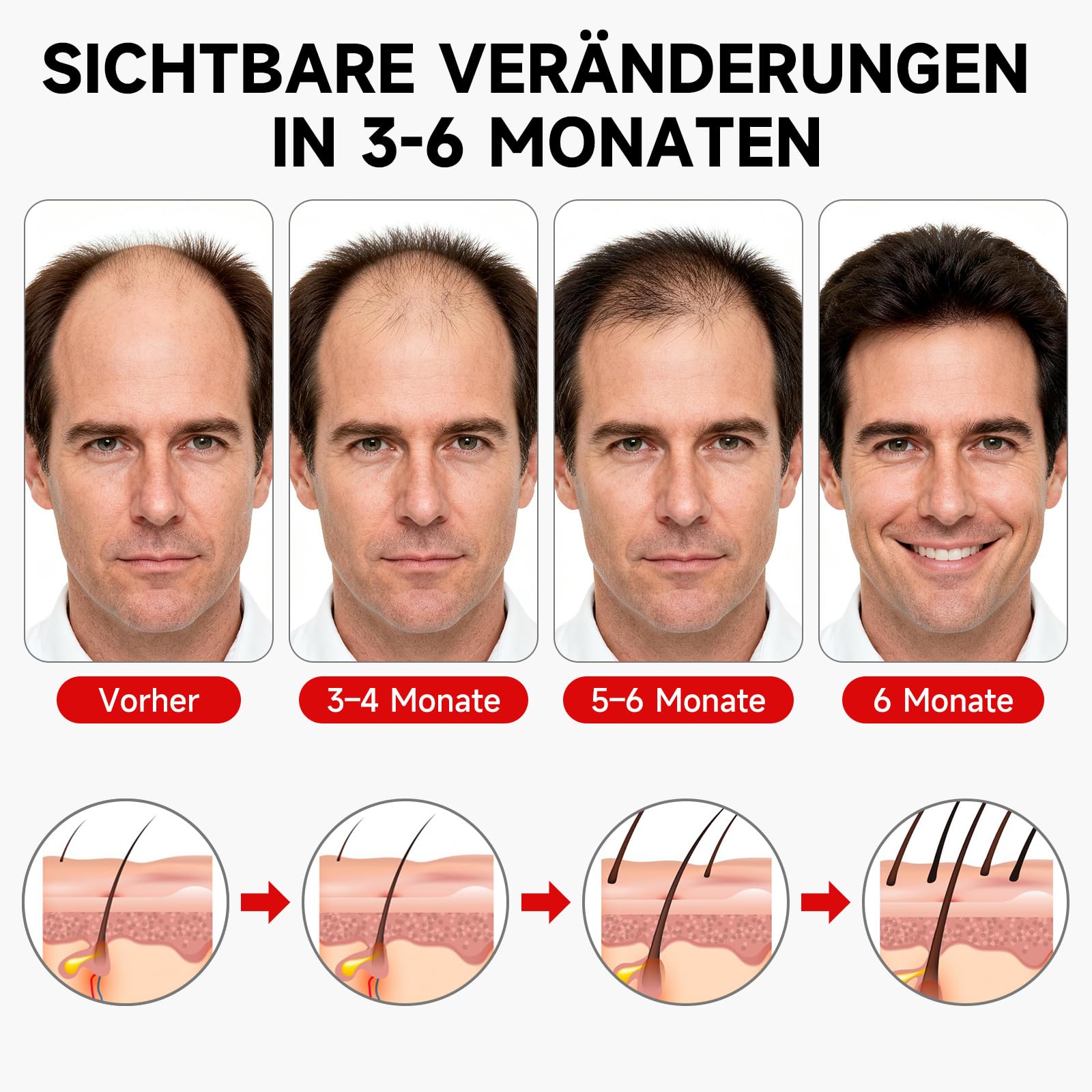 Rotlicht Haarwachstumskappe, 660nm+850nm Rotlicht Haare, Haarwuchskappe Einstellbare Größe, 7 Modi, Abnehmbarem Rotlicht Panel, Hair Growth Cap für Männer/Frauen