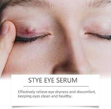 Eye Cream for Dark Circles and Puffy Eyes,Restore Healthier Eye Skin,Under Eye Serum,Dark Circle Eye Cream & Anti Aging Ey/e Gel,Stye Ey/e Treatment,Natural E/ye Bags Remover for Women,E/ye Care Serum