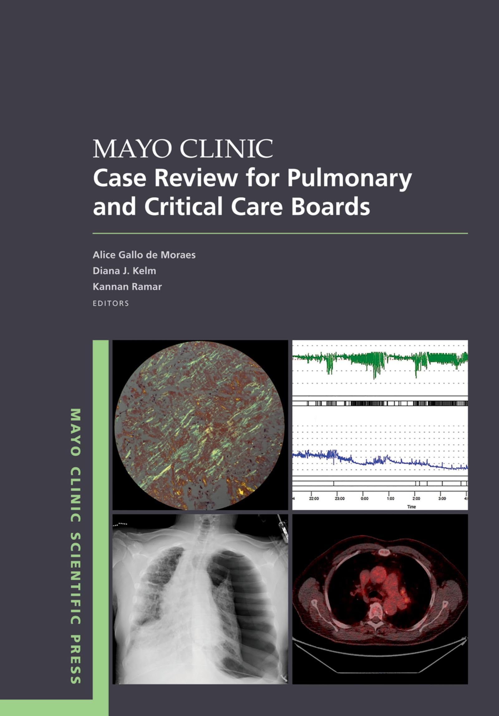 Mayo Clinic Case Review for Pulmonary and Critical Care Boards (Mayo Clinic Scientific Press) (English Edition)