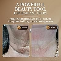 Vista 4 de GLO24K - Dispositivo de belleza facial y cuello con luz roja, herramienta de masajeador facial 3 en 1 con LED y vibración para revitalización