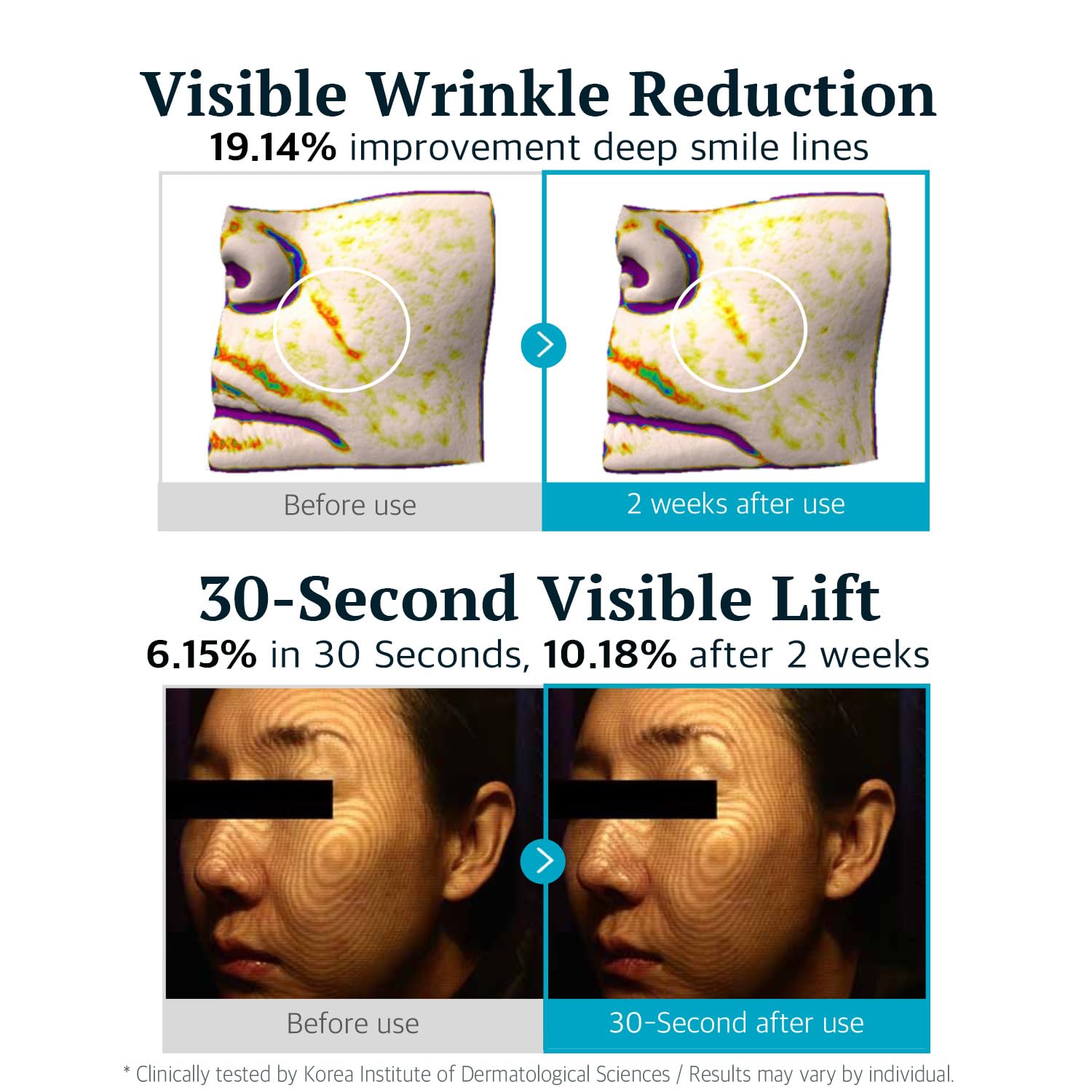 Re.SPN Peptide Lifting Roller Serum – For Wrinkles, Lifting & Pore Tightening on Face & Neck with Gua Sha Applicator, Vegan, Anti-wrinkle Peptide, Niacinamide, K-Beauty (1.69 fl oz) - Image 3