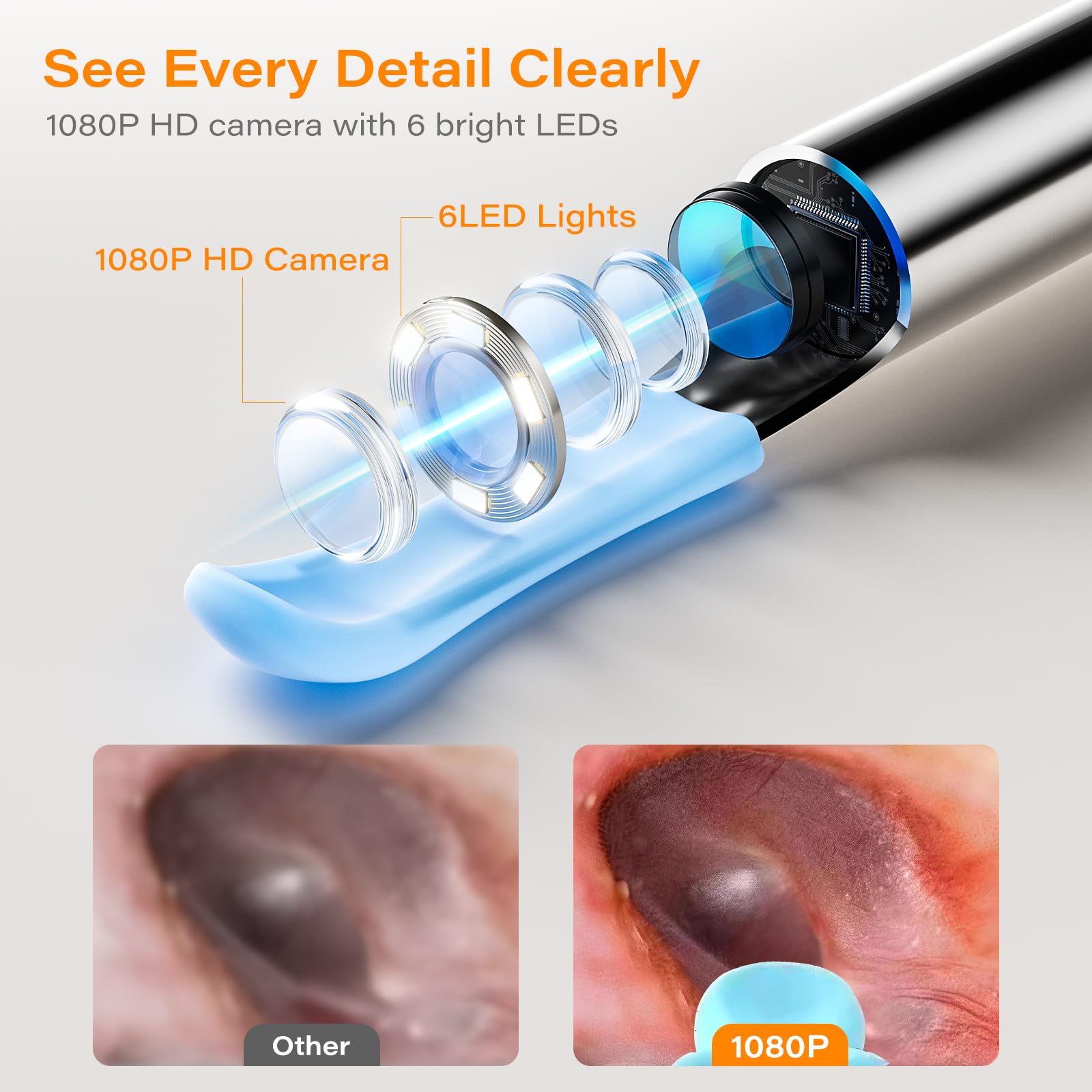 Otoscope Cure Oreille Avec Écran Intégré Et Gyroscope, Pas De Téléphone, Pas D'Application, Pas De WiFi, Nettoyage Caméra 1080P HD Avec 6 LED, Kit Élimination Cérumen Pour Seniors Et Toute La Famille