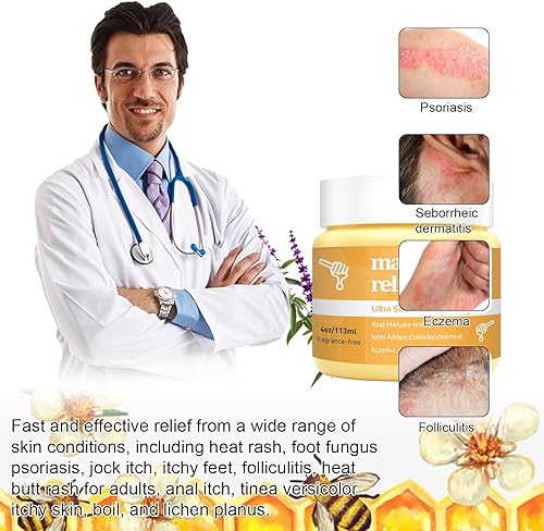 Miniatura 4 de Crema calmante para eccema de miel de Manuka, manos orgánicas, alivio del eccema corporal, ungüento natural para psoriasis, tiña de pies de mano,