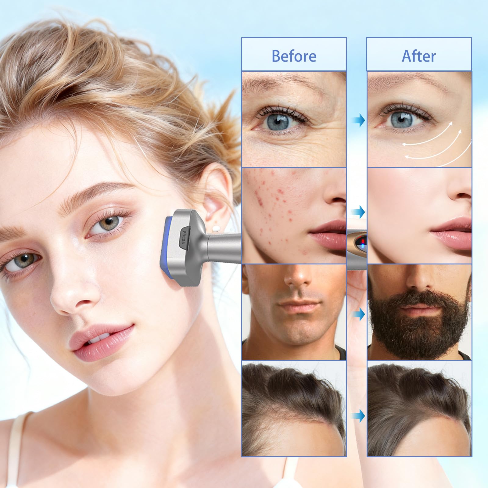 Microneedling Stamp Bio 6 – Derma Stamp Professionale 4 in 1 con Microneedling, EMS, Terapia Luce Rossa/Blu, Massaggio Vibrante– Ringiovanimento Viso, Anti-Età, Crescita Capelli