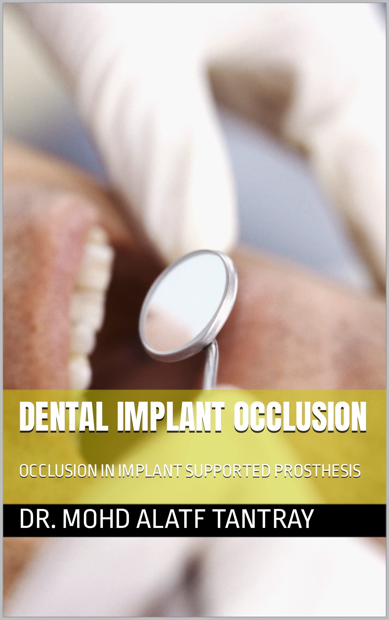 Buy DENTAL IM OCCLUSION OCCLUSION IN IM SUPPORTED PROSTHESID Online at