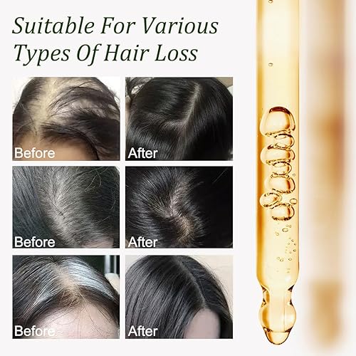 Miniatura 4 de Aceite de batana para el crecimiento del cabello, 100% puro, aceite natural para el crecimiento del cabello, nutre el cuero cabelludo, elimina las