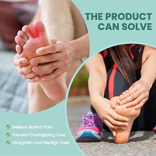 Miniatura 5 de Welnove Separador de dedos para dedos superpuestos  Espaciadores de dedos para juanetes  Corrector de dedos para dedos de martillo, realinear dedos