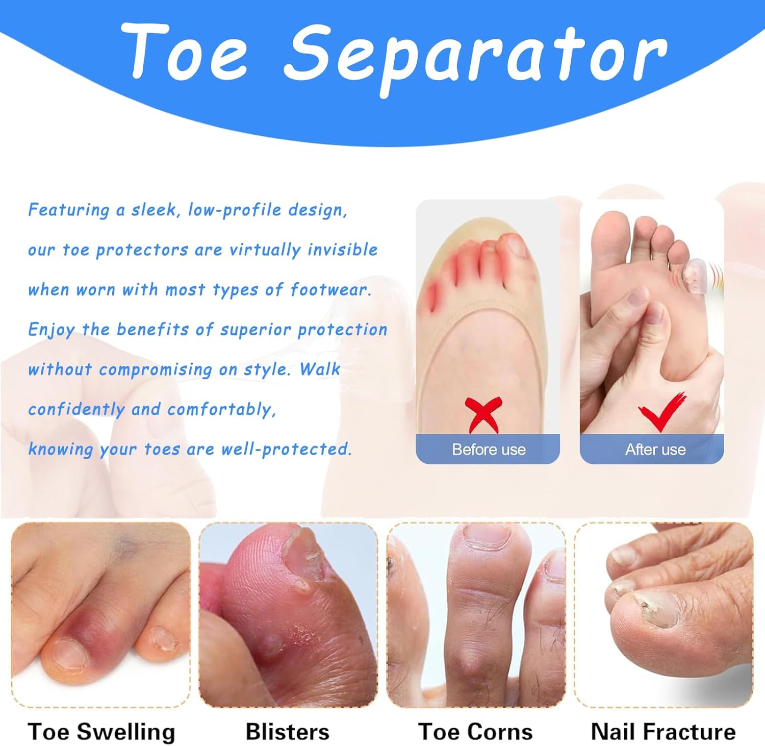 Silicone Anti-Friction Toe Protector, Silicone Toe Protectors, Gel Toe Protectors, Breathable Little Toe Covers, Blisters, Calluses, and Corns Protection (100PCS)