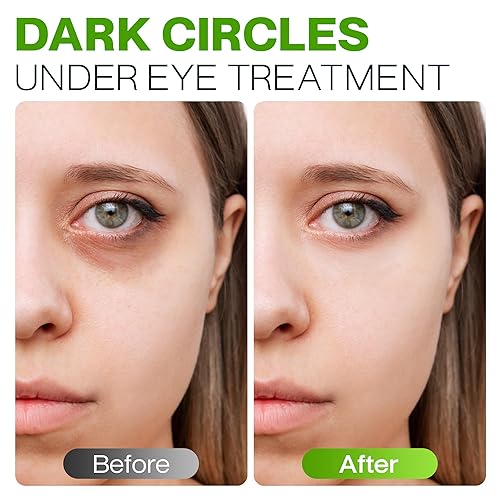 Miniatura 4 de Crema antienvejecimiento para debajo de los ojos, tratamiento completo de péptidos para ojos con ácido hialurónico, aloe, vitamina E, aminoácidos,