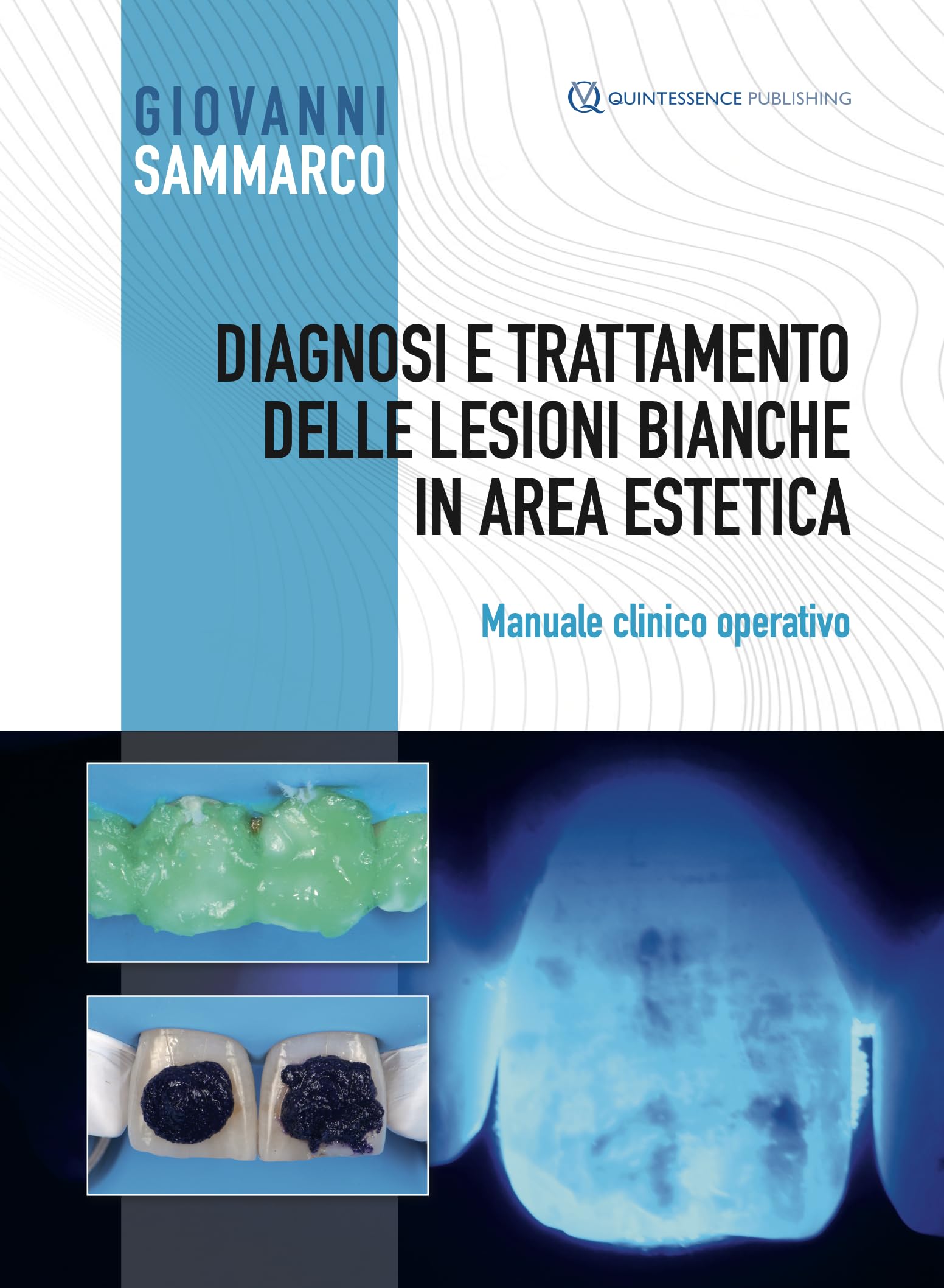 Diagnosi e trattamento delle lesioni bianche in area estetica. Manuale clinico operativo