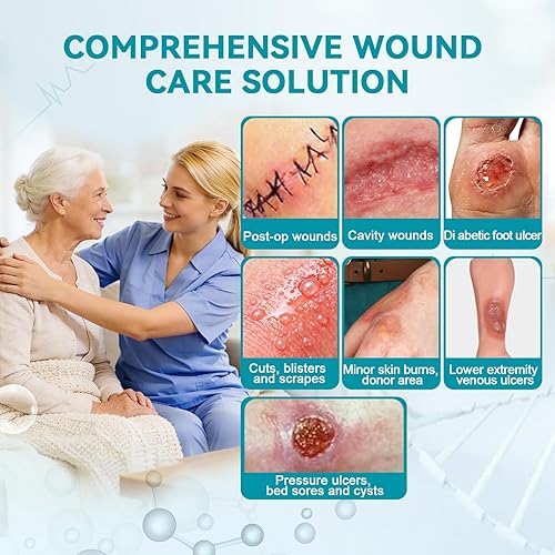 Miniatura 2 de Dimora Apósito para heridas de alginato de calcio, parches de 4 x 4 pulgadas, 10 almohadillas estériles individuales, gasa suave y altamente