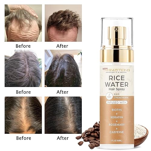 Miniatura 8 de Fermented Rice Water For Hair Growth With Rosemary,Biotin & Keratin - Strengthen,Nourish,& Revitalize Your Hair & Scalp - Paraben & Sulfate-Free